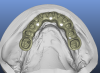 lower occlusal.png