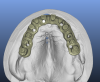 occlusal view upper.png