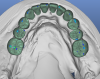 lower crowns occlusal.png