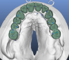upper crowns occlusal.png