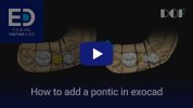 #20 How to Add a Pontic in exocad_4.jpg