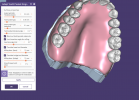 Exocad Adapted Teeth Settings.PNG