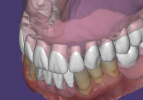 Exocad Adapted Teeth Settings2.PNG
